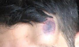 Confinement - Aux Ulis, deuxième passage à tabac en moins d’une semaine - VIDEO2