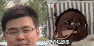 Coronavirus : la peau de deux médecins chinois infectés devient noire