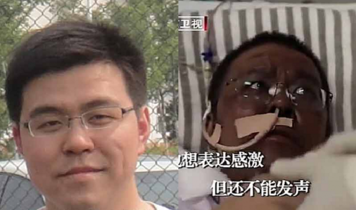 Coronavirus : la peau de deux médecins chinois infectés devient noire