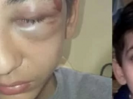 Gabriel, 14 ans, hospitalisé après avoir été roué de coups par la police