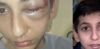 Gabriel, 14 ans, hospitalisé après avoir été roué de coups par la police