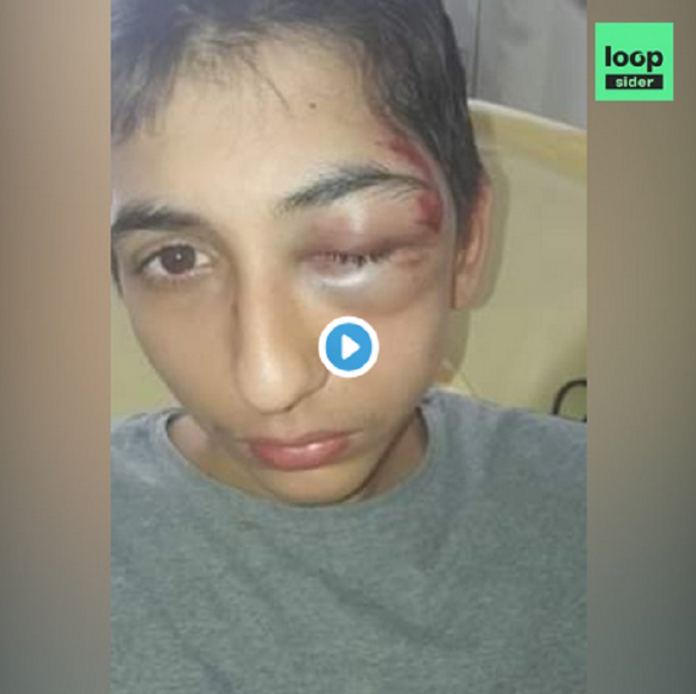 Gabriel, 14 ans, frappé par la police et hospitalisé, témoigne pour la première fois - VIDÉO