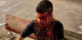 Toulouse : Salim, 18 ans, sauve une fille victime d'un viol puis se fait rouer de coups