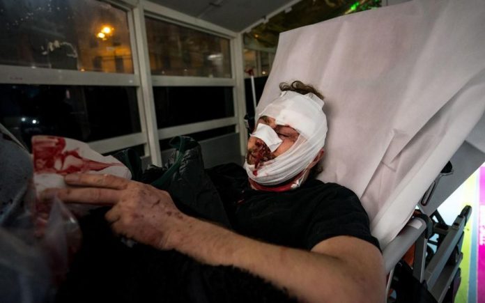 Marches des Libertés - un photographe syrien blessé à coups de matraque par la police