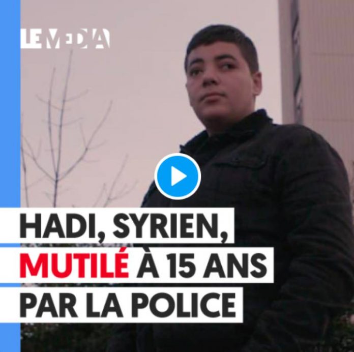 Hadi, jeune syrien de 15 ans éborgné par la police française - VIDEO