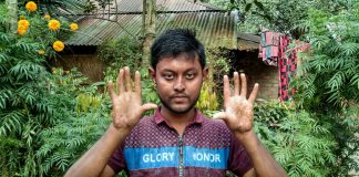 Bangladesh : les hommes de cette famille n’ont pas d’empreintes digitales