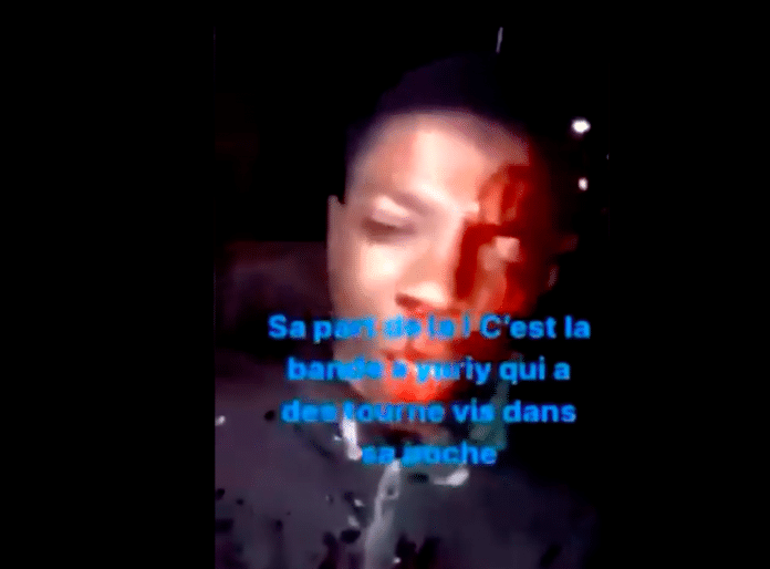 La vidéo d’un jeune homme tabassé par « les amis de Yuriy » fait scandale - VIDEO