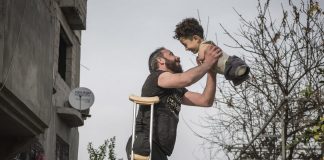 Italie - Un garçon syrien né sans membre va recevoir quatre prothèses après une collecte de dons