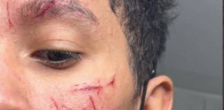Un homme accuse une dizaine d’hommes racistes de lui avoir scarifié une croix gammée sur le visage avec