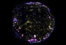 Des scientifiques créent un « poumon-sur-puce » pour étudier les maladies