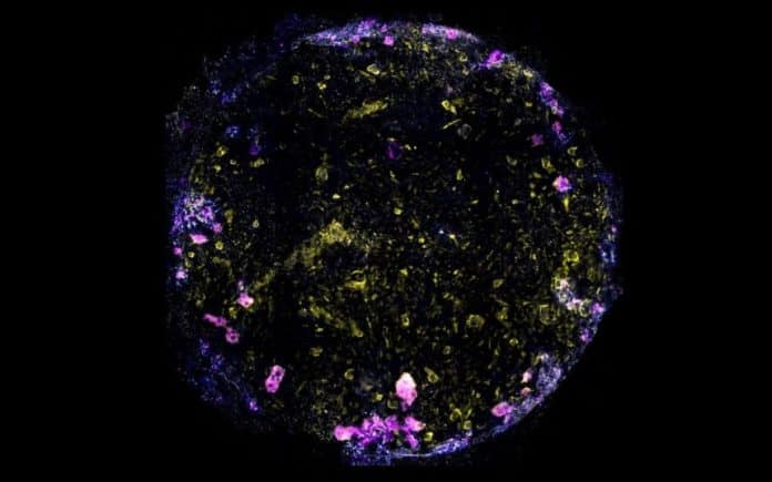 Modele de poumon sur puce